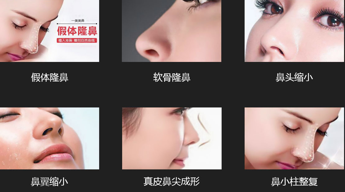 美鼻